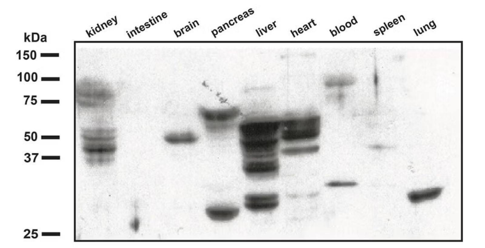 Western blot showing inflammation markers in different organs