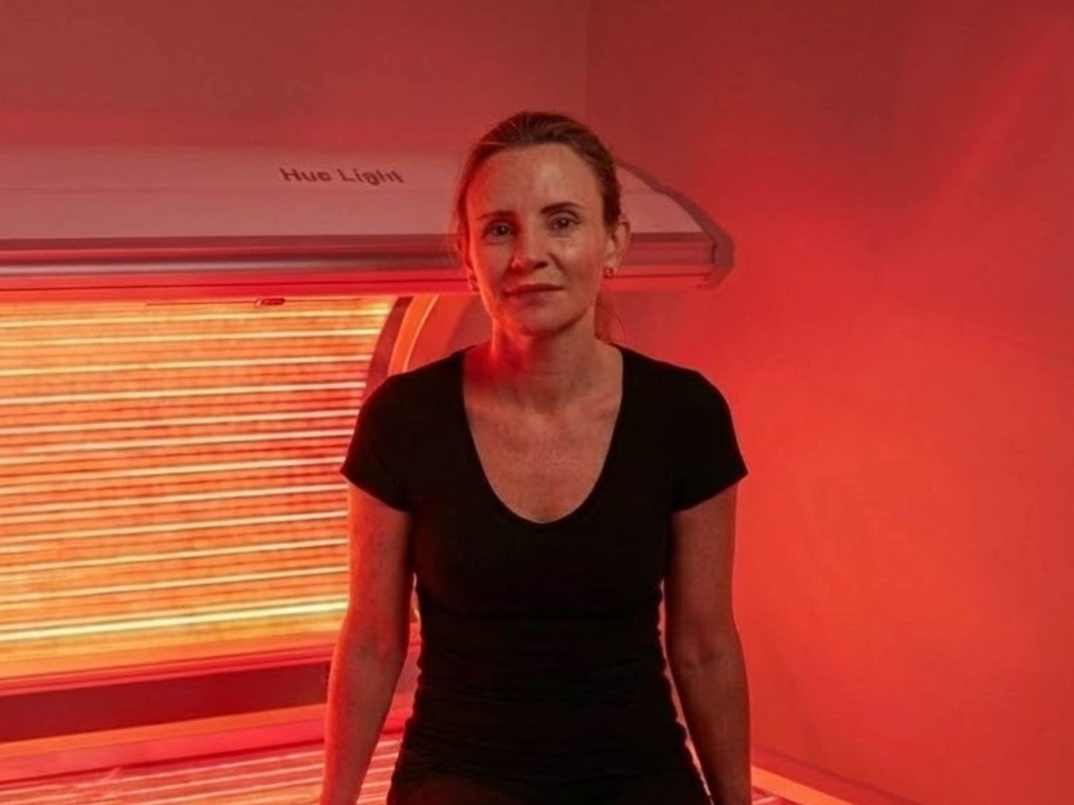 red Light Therapy for perioral dermatitis result 